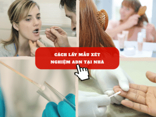 Cách Lấy Mẫu Xét Nghiệm ADN Tại Nhà Đơn Giản, Dễ Thực Hiện cach-lay-mau-xet-nghiem-adn-tai-nha