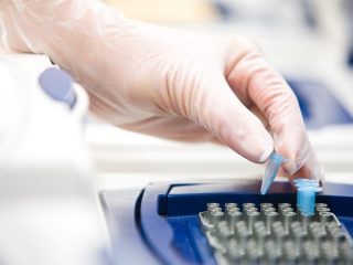 Xét Nghiệm ADN Bằng Móng Tay Có Chính Xác Không? xet-nghiem-adn-bang-mong-tay-co-chinh-xac-khong-6