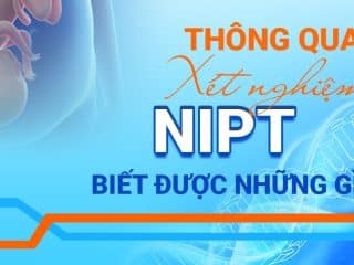 Các Gói Xét Nghiệm NIPT, Nên Chọn Gói Nào? Xét nghiệm NIPT biết được những gì