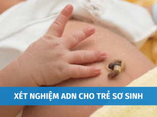 Xét Nghiệm ADN Cho Trẻ Sơ Sinh Có An Toàn Và Chính Xác Không? xet-nghiem-adn-cho-tre-so-sinh-1