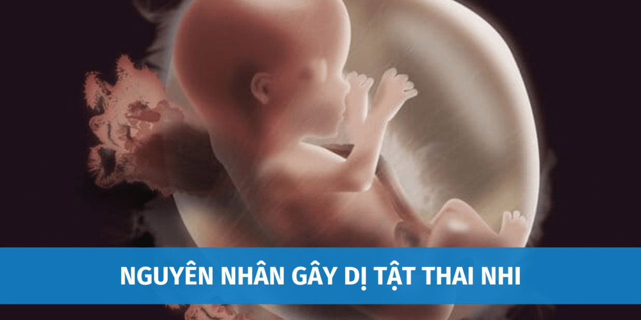 Top Nguyên Nhân Gây Dị Tật Thai Nhi Mẹ Bầu Cần Đọc Ngay
