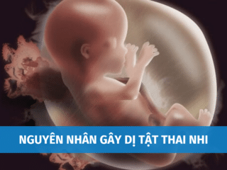 Top Nguyên Nhân Gây Dị Tật Thai Nhi Mẹ Bầu Cần Đọc Ngay nguyen-nhan-day-di-tat-thai-nhi-3
