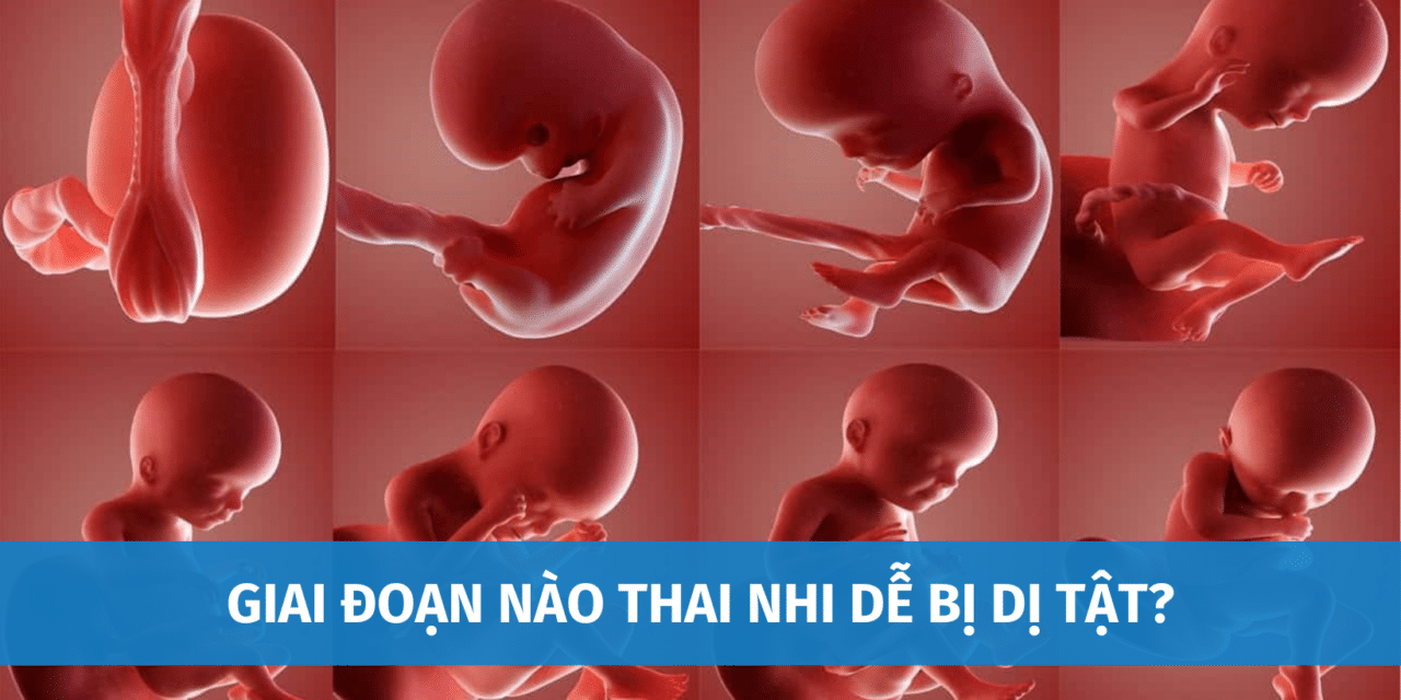 Giai Đoạn Nào Thai Nhi Dễ Bị Dị Tật? 3 Thời Điểm Vàng Giúp Pháp Hiện Dị Tật Thai Nhi