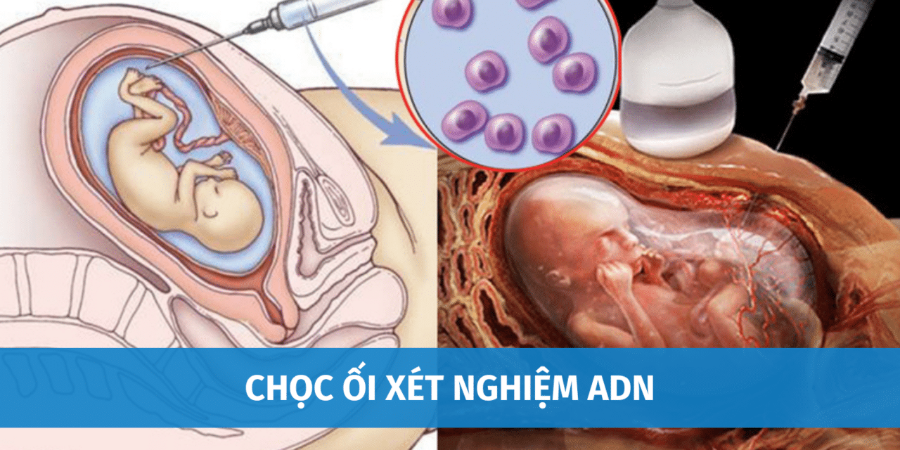 Chọc Ối Xét Nghiệm ADN Là Gì? Có Nguy Hiểm Không? Chi Phí Bao Nhiêu?