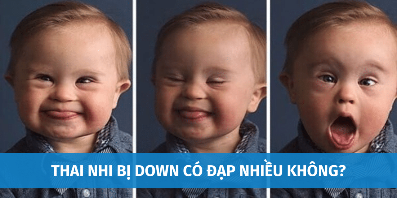 Thai Nhi Bị Down Có Đạp Nhiều Không? Phương Pháp Xác Định Trẻ Bị Down Trong Bụng Mẹ