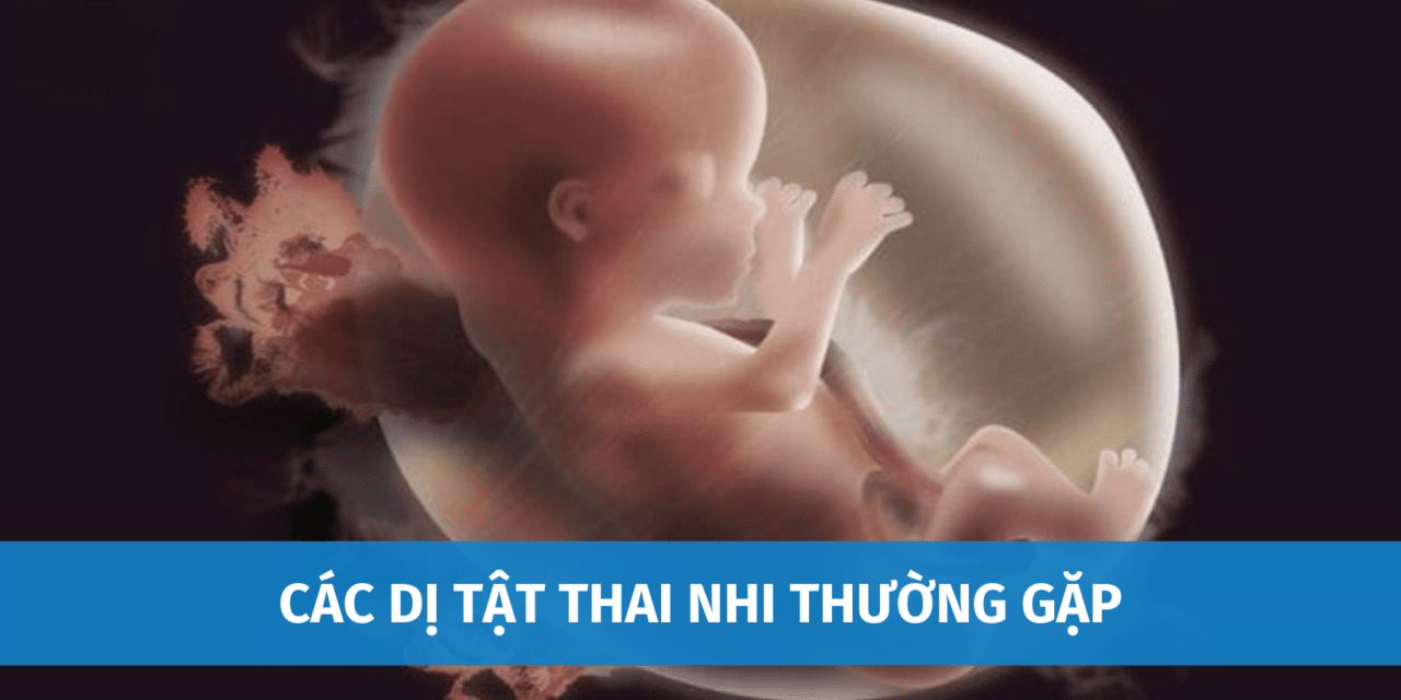 Các Dị Tật Thai Nhi Thường Gặp | Làm Sao Để Biết Thai Bị Dị Tật?