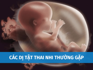 Các Dị Tật Thai Nhi Thường Gặp | Làm Sao Để Biết Thai Bị Dị Tật? cac-di-tat-thai-nhi-thuong-gap-1