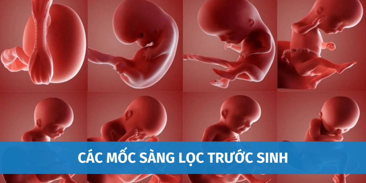 Các Mốc Sàng Lọc Trước Sinh Mẹ Bầu Cần Biết Để Có Thai Kỳ Khỏe Mạnh