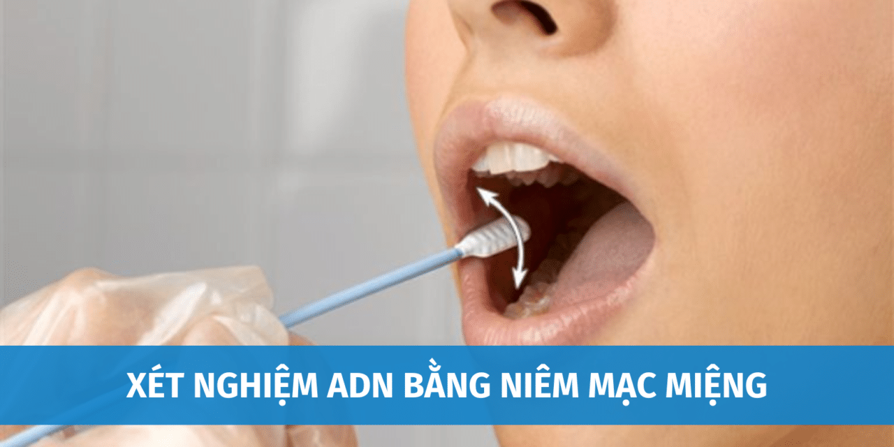 Xét Nghiệm ADN Bằng Niêm Mạc Miệng Và Những Điều Cần Biết