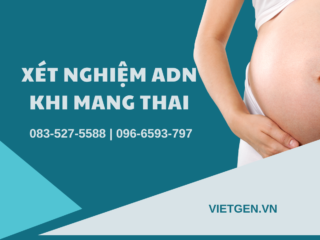 Xét Nghiệm ADN Khi Mang Thai Được Thực Hiện Theo Phương Pháp Nào? xet-nghiem-adn-khi-mang-thai