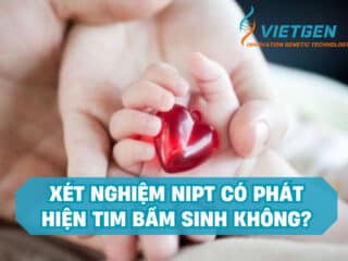 Giải Đáp: Xét Nghiệm NIPT Có Phát Hiện Tim Bẩm Sinh Không? Xét nghiệm NIPT có phát hiện tim bẩm sinh không